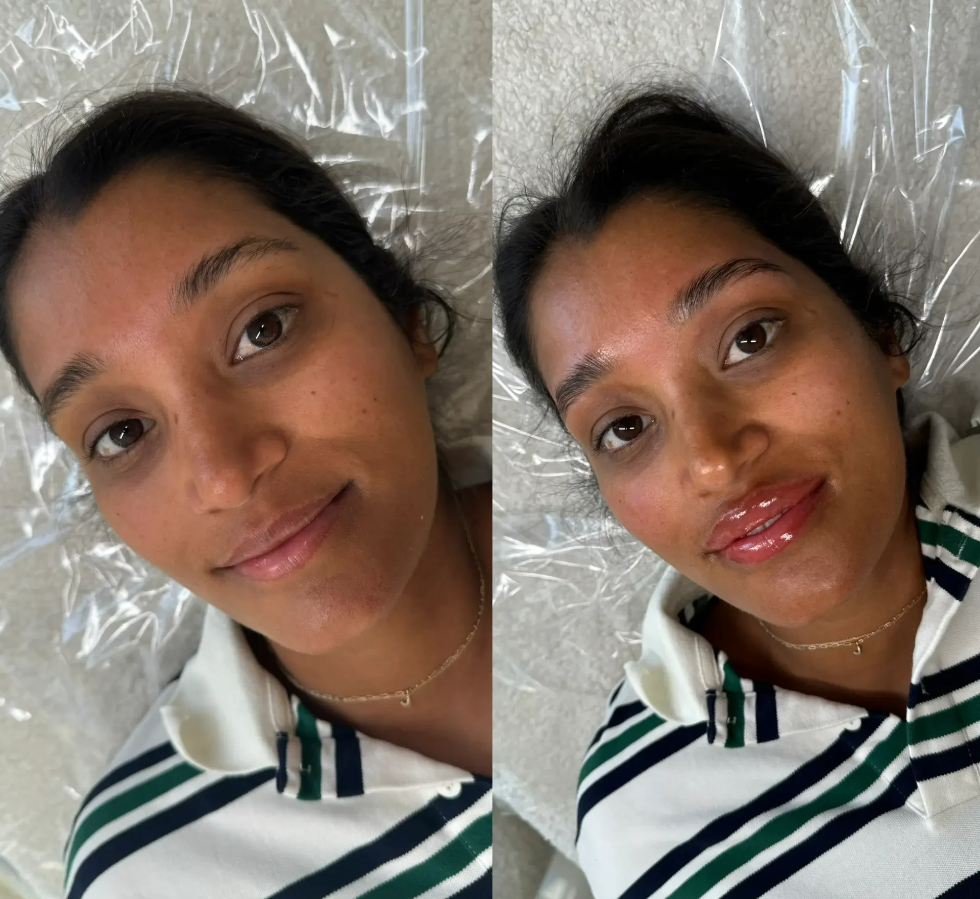 Before and after of lip blush on deeper skin, adding definition and even colour
